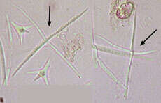 Imagem de Alatospora acuminata Ingold 1942