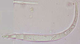 Image of Anguillospora crassa Ingold 1958