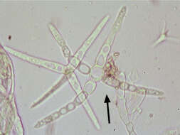 Image of Lemonniera cornuta Ranzoni 1953