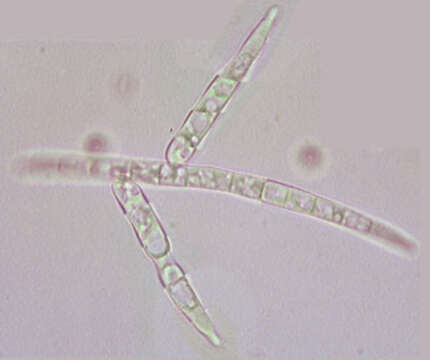 Hymenoscyphus splendens Abdullah, Descals & J. Webster 1981的圖片