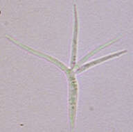 Image of Alatospora acuminata Ingold 1942