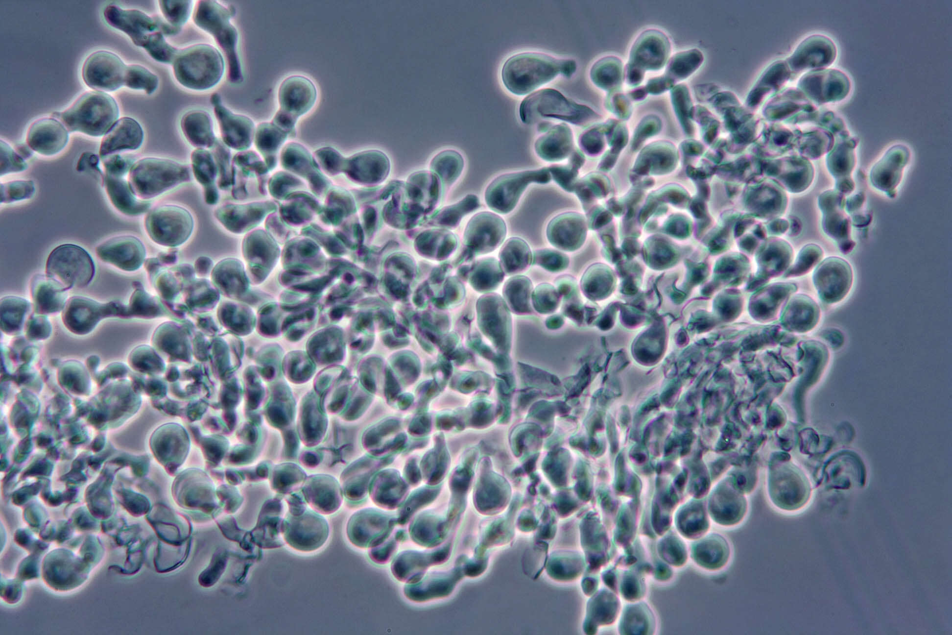 Image of Bulbillomyces