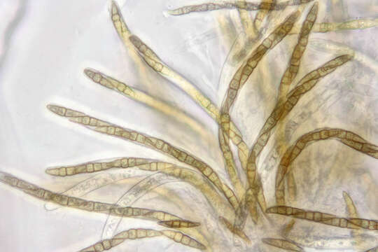 Слика од Leptosphaeria doliolum (Pers.) Ces. & De Not. 1863