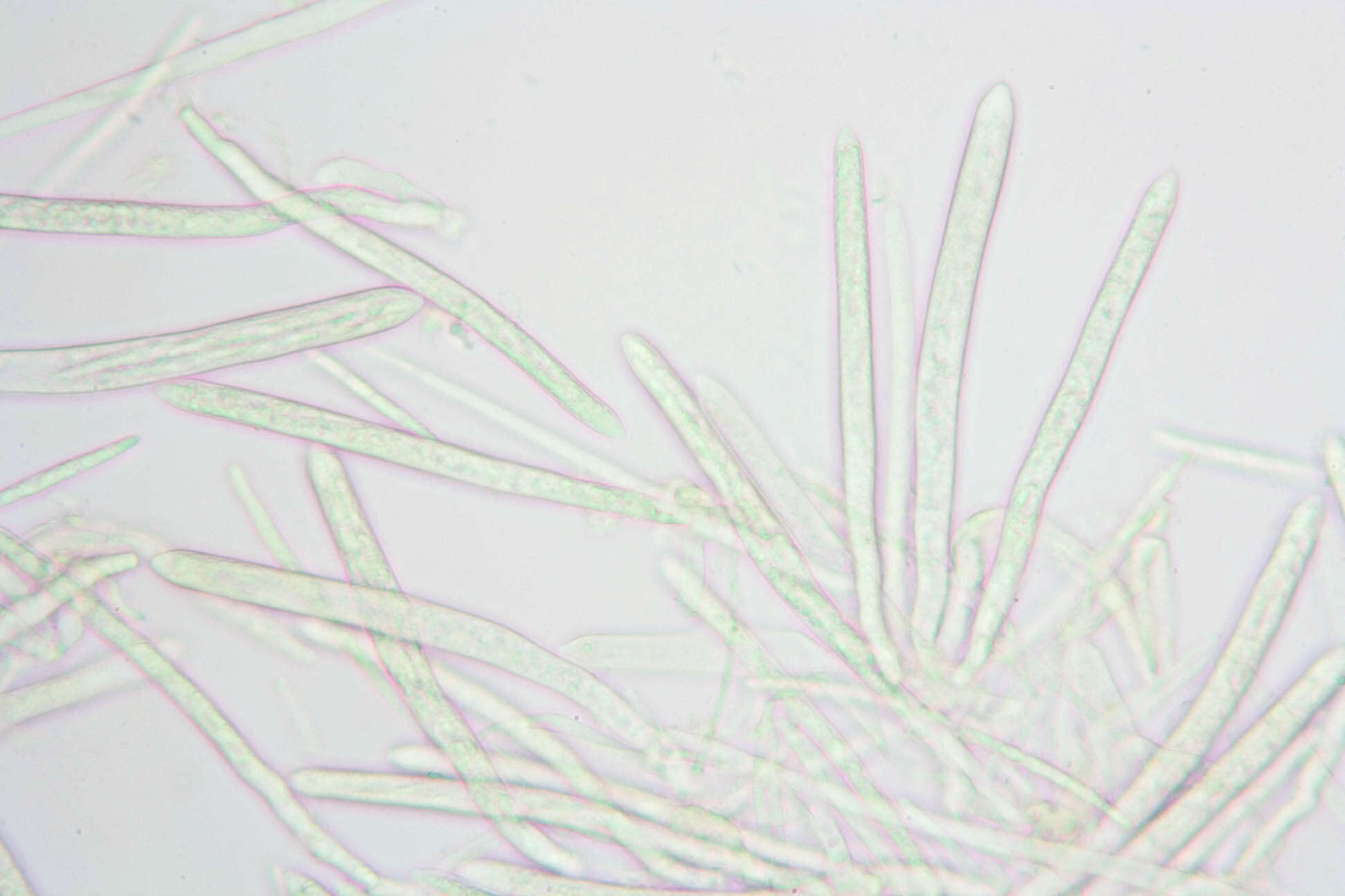 Image of Belonidium sulphureum (Fuckel) Raitv. 1970