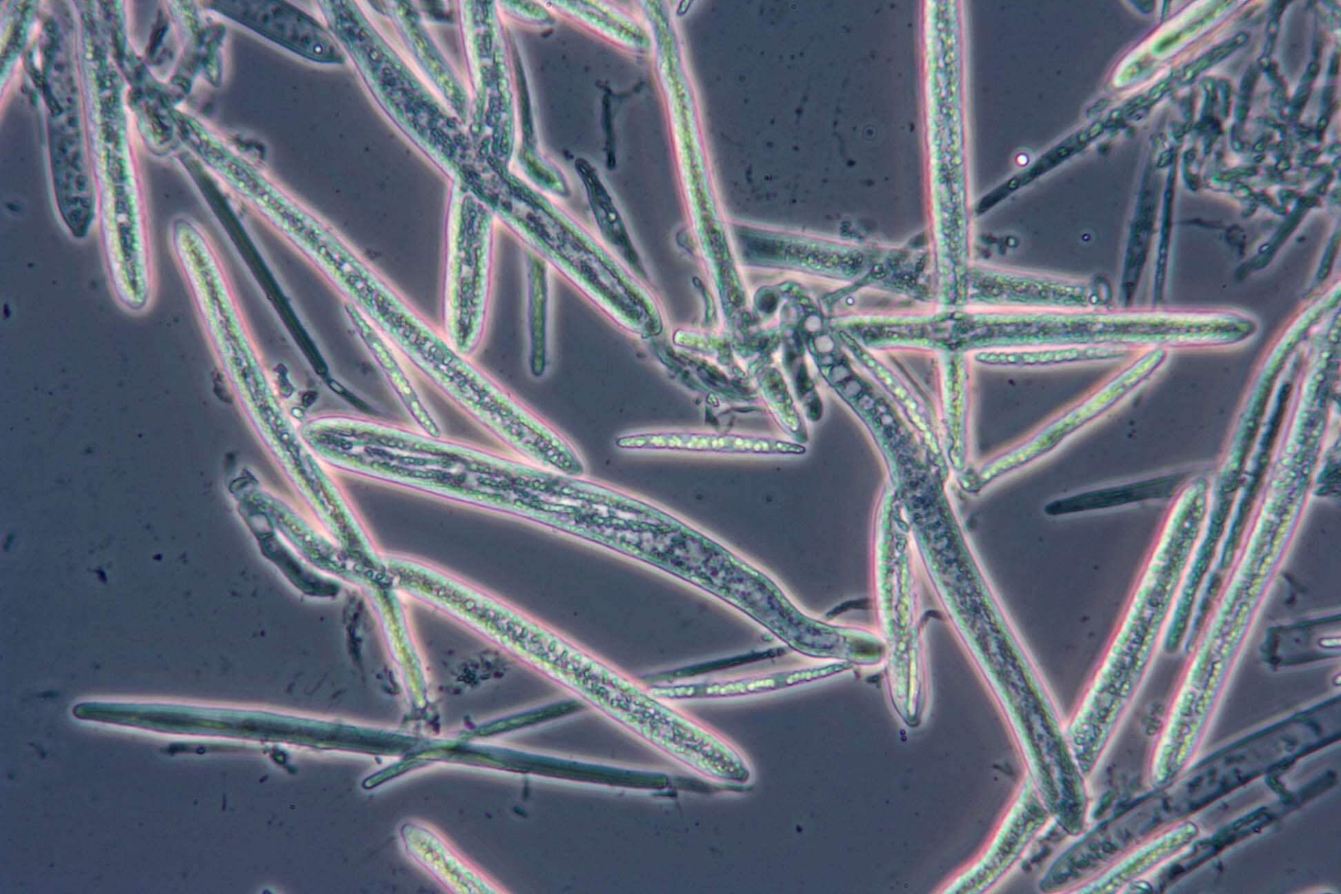 Image of Belonidium sulphureum (Fuckel) Raitv. 1970