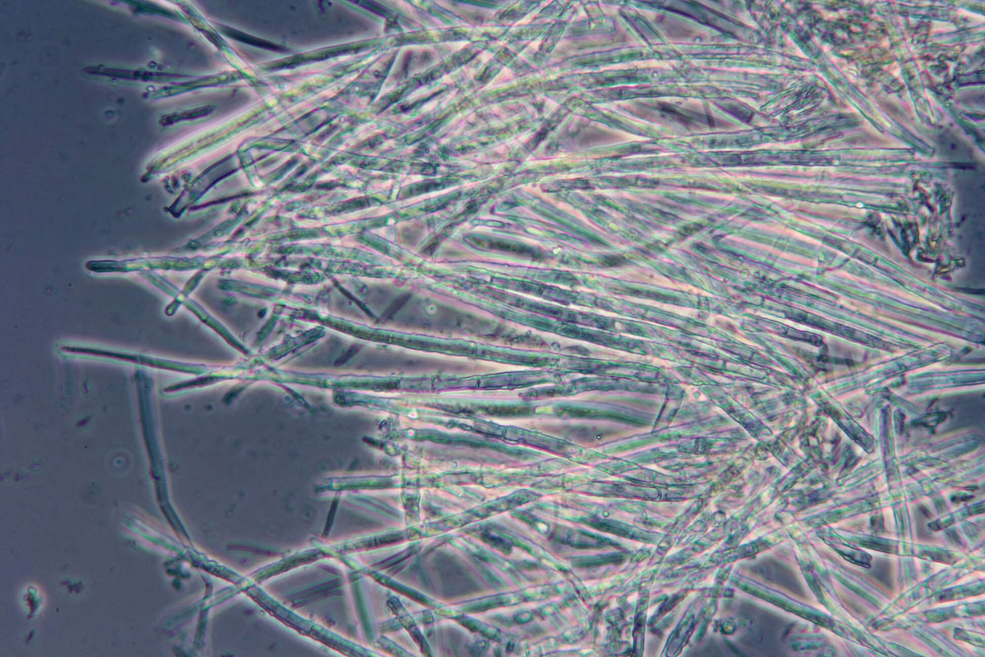 Image of Belonidium sulphureum (Fuckel) Raitv. 1970