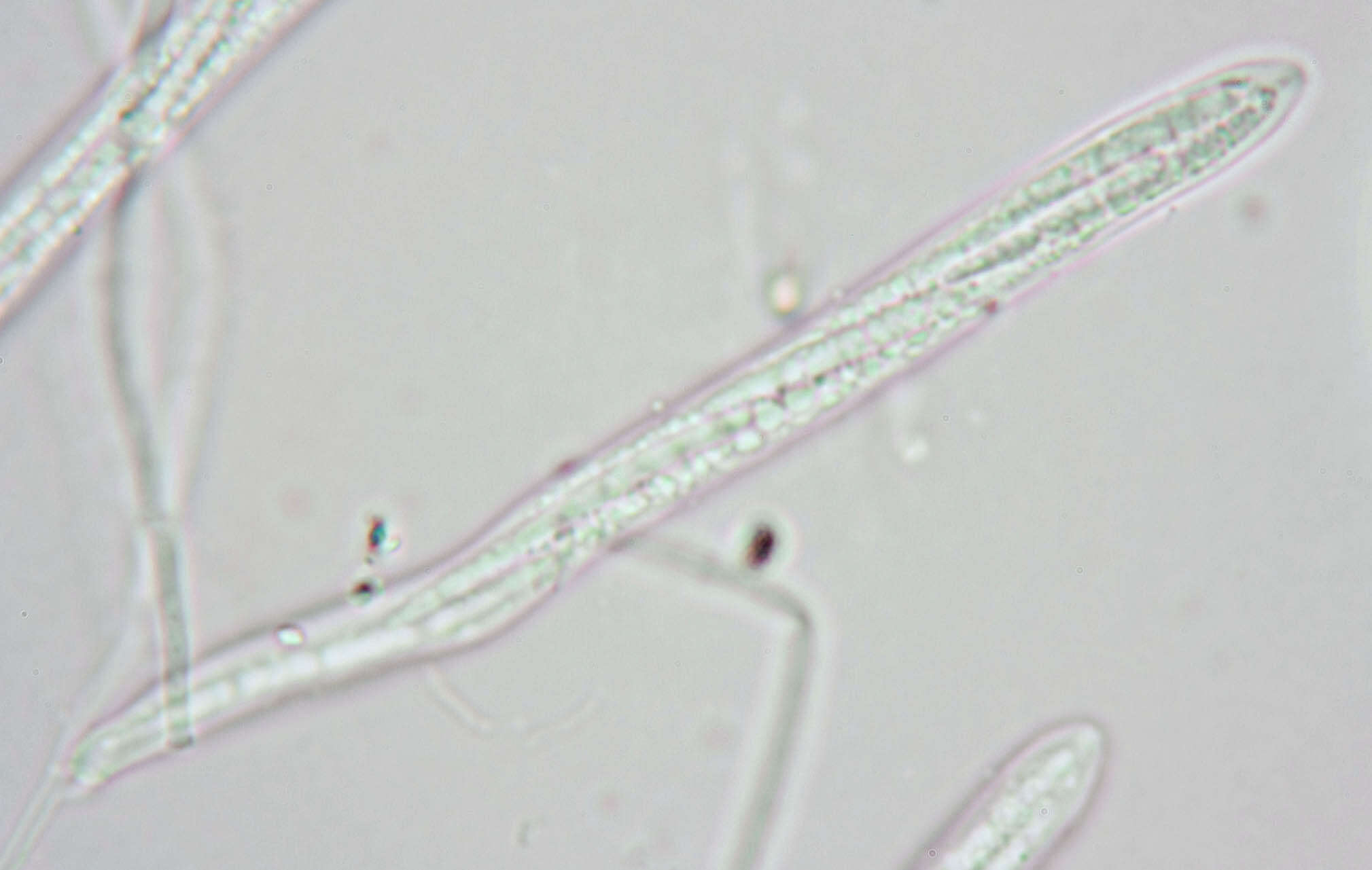 Image of Belonidium sulphureum (Fuckel) Raitv. 1970