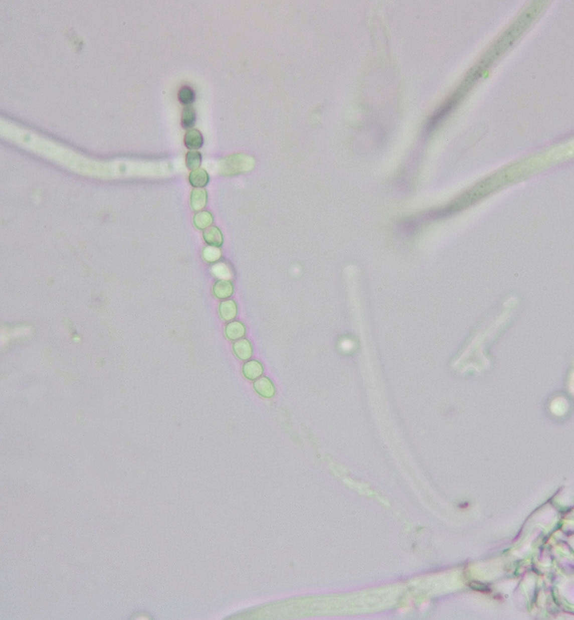 Image of Trichoderma minutisporum Bissett 1992