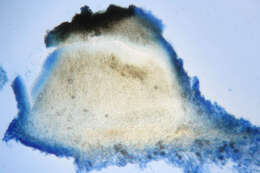 Image of Ascomycota