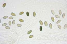 Image of Nail fungus