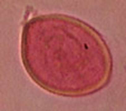 Image of Phaeotremella foliacea (Pers.) Wedin, J. C. Zamora & Millanes 2016