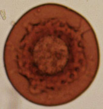 Image of Arcella discoides