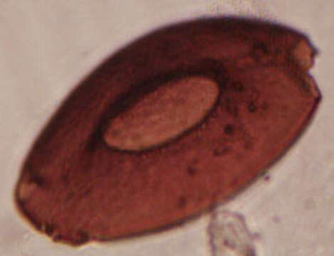 Image of Arcella discoides