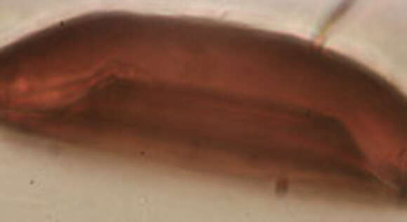 Image of Arcella discoides