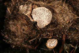 Image of Nail fungus