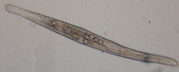 Image de Spirostomidae