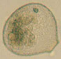 Image of Nebela flabellulum