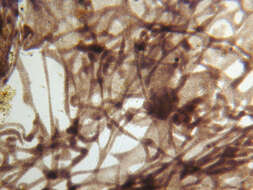 Image of <i>Lamprocystis roseo-persicina</i>