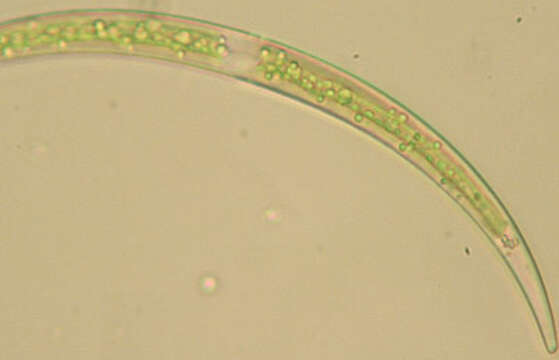 Image de Closterium parvulum Nägeli 1849