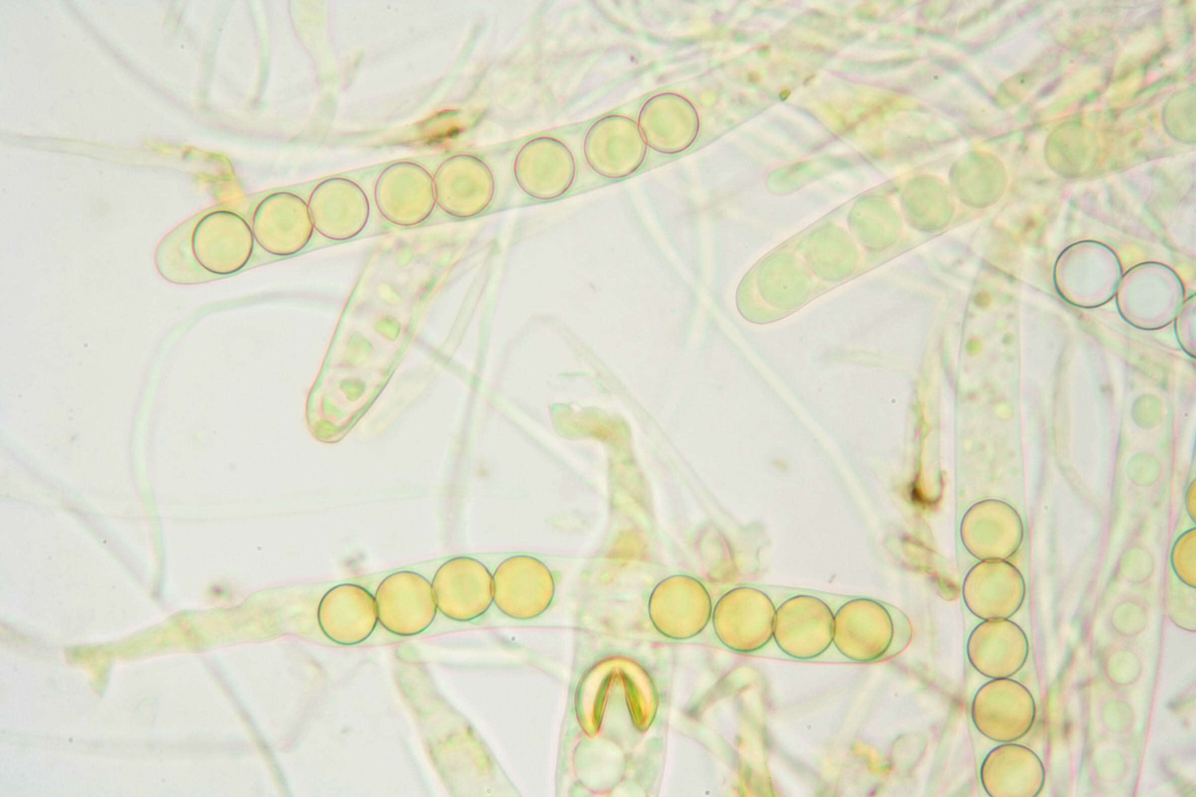 Plancia ëd Sphaerosporella