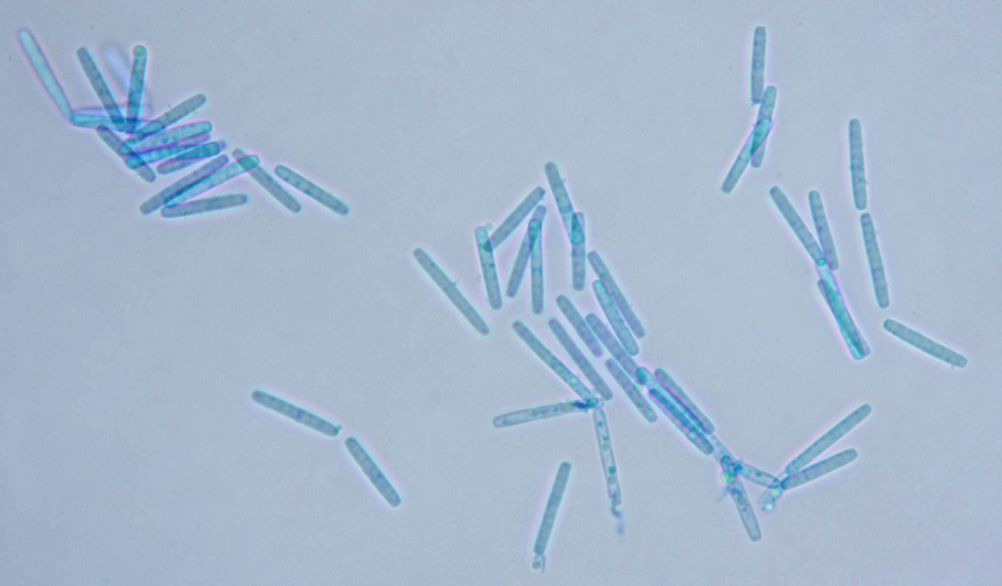 Image of Hypocreales