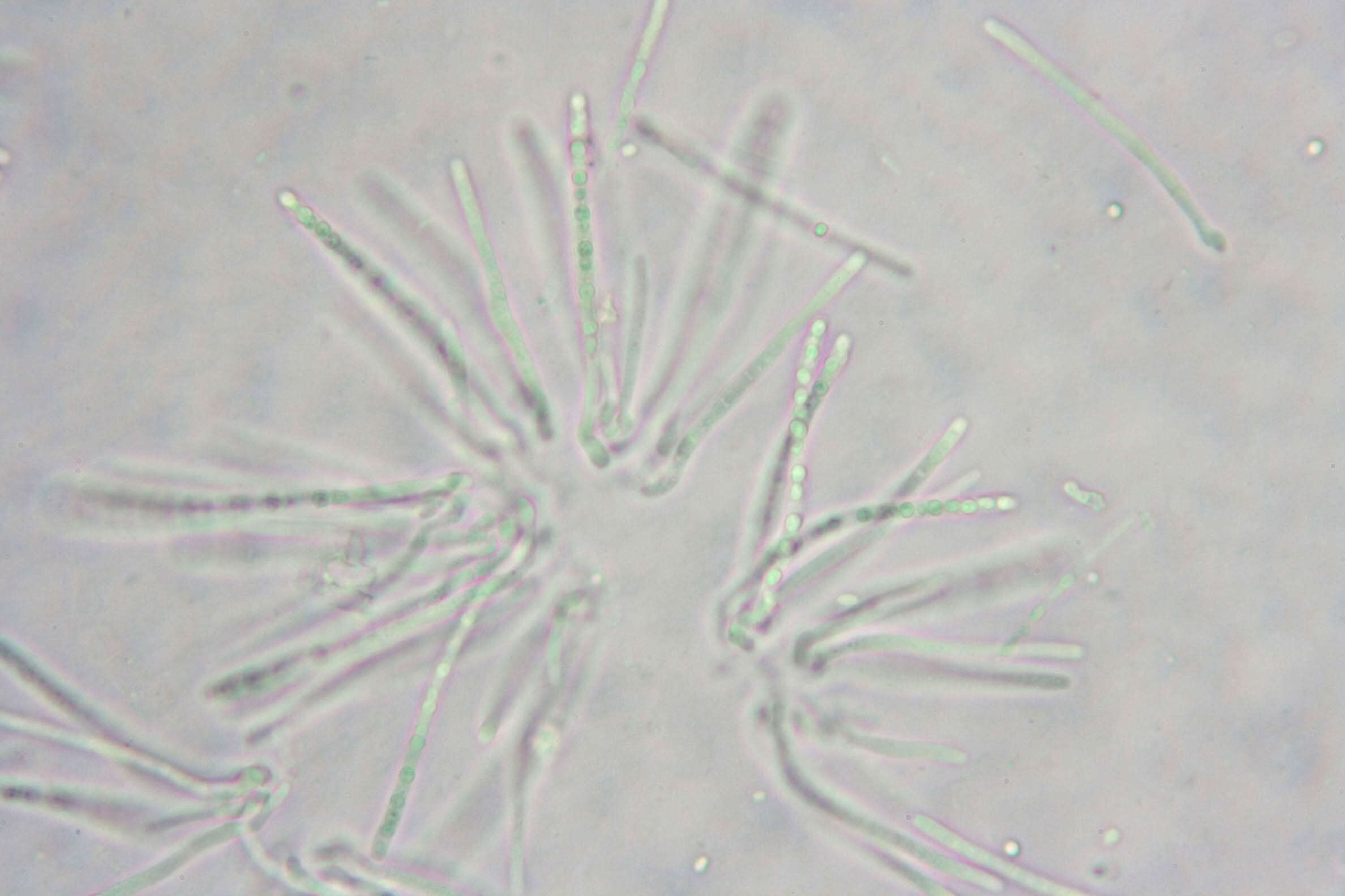 Image de Protocrea farinosa (Berk. & Broome) Petch 1937