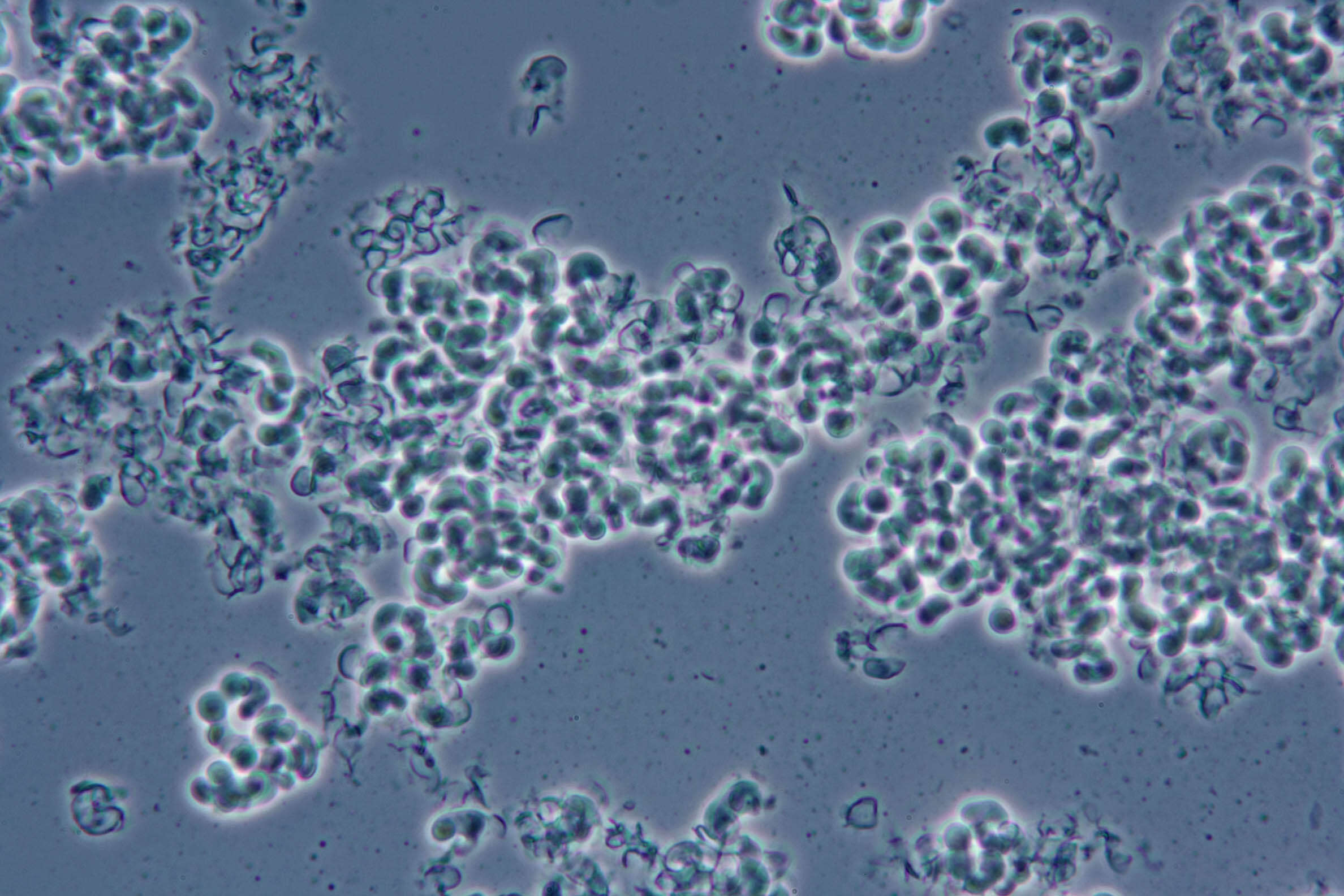 صورة Illosporiopsis