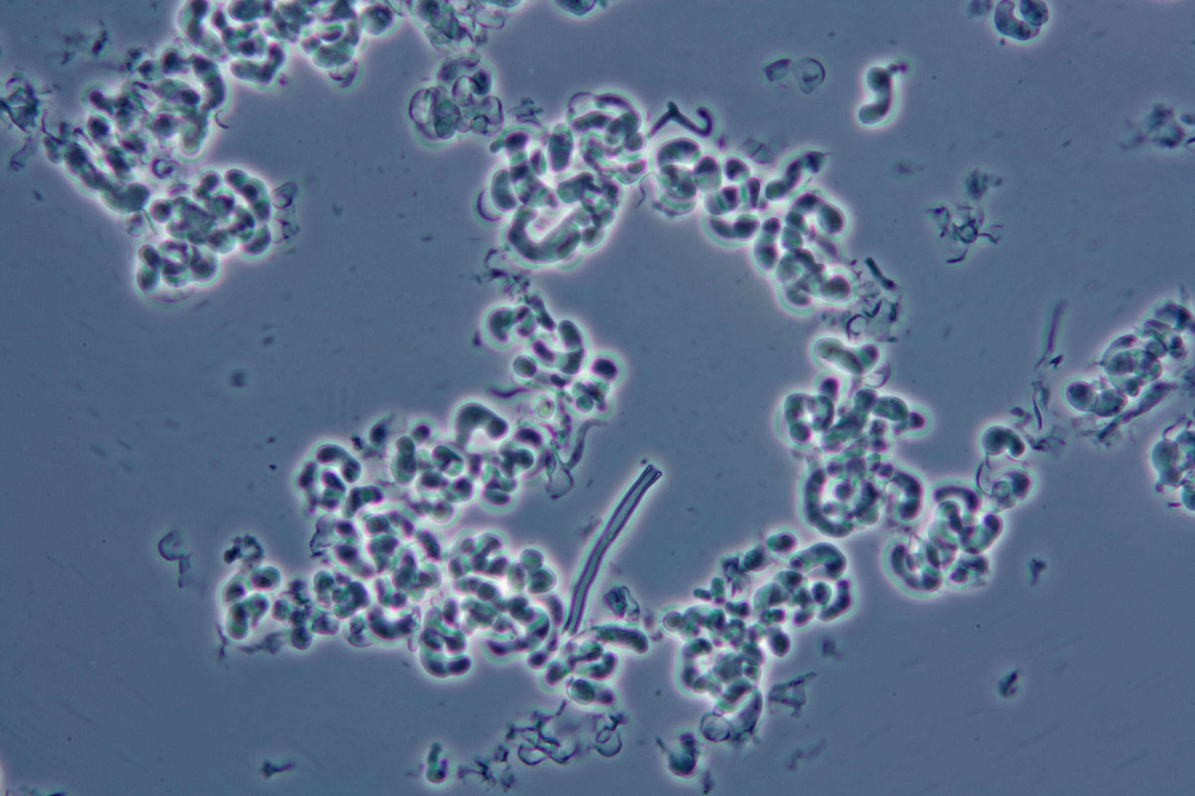 صورة Illosporiopsis