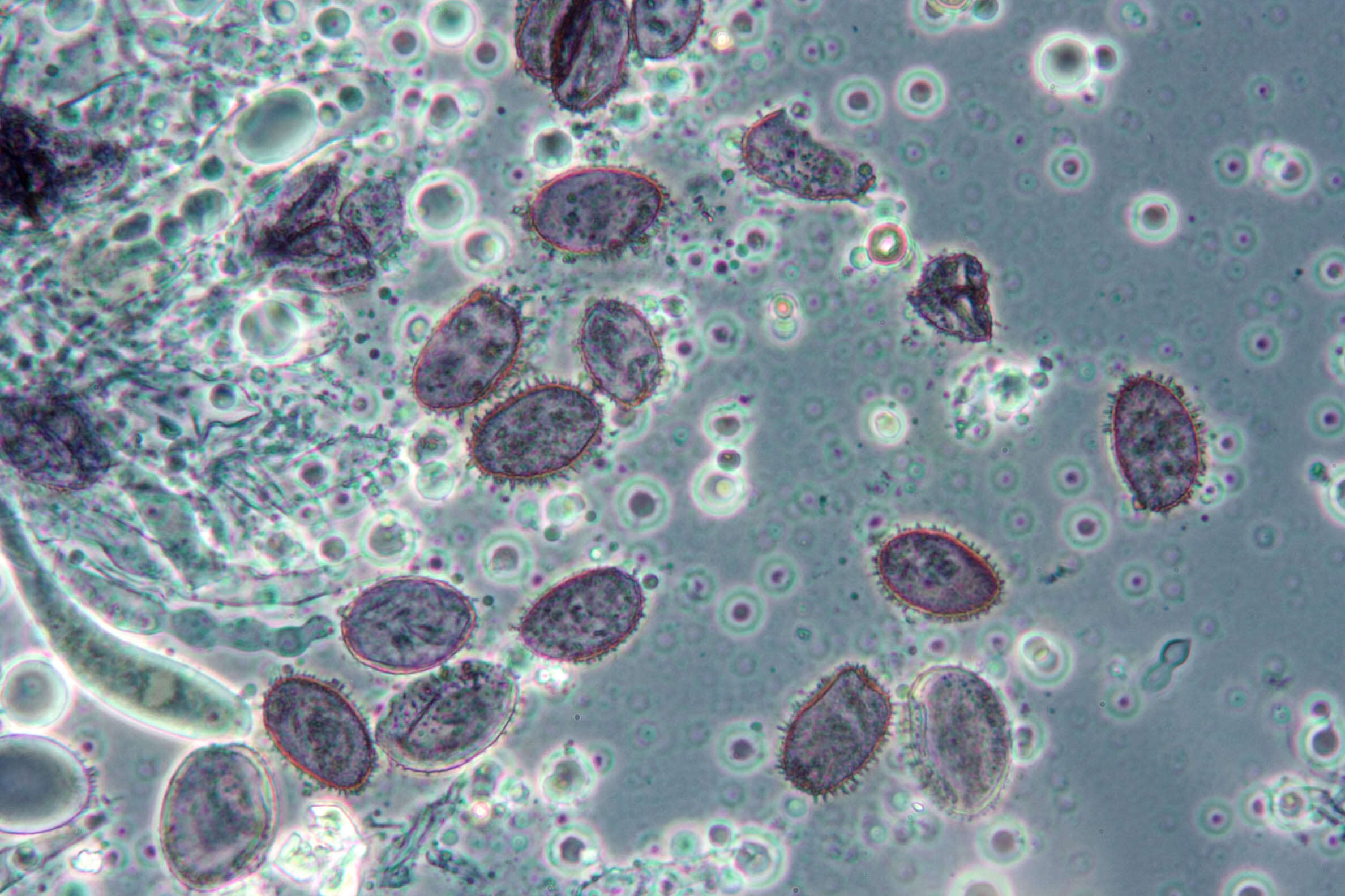 Image of Aleurodiscus wakefieldiae Boidin & Beller 1967