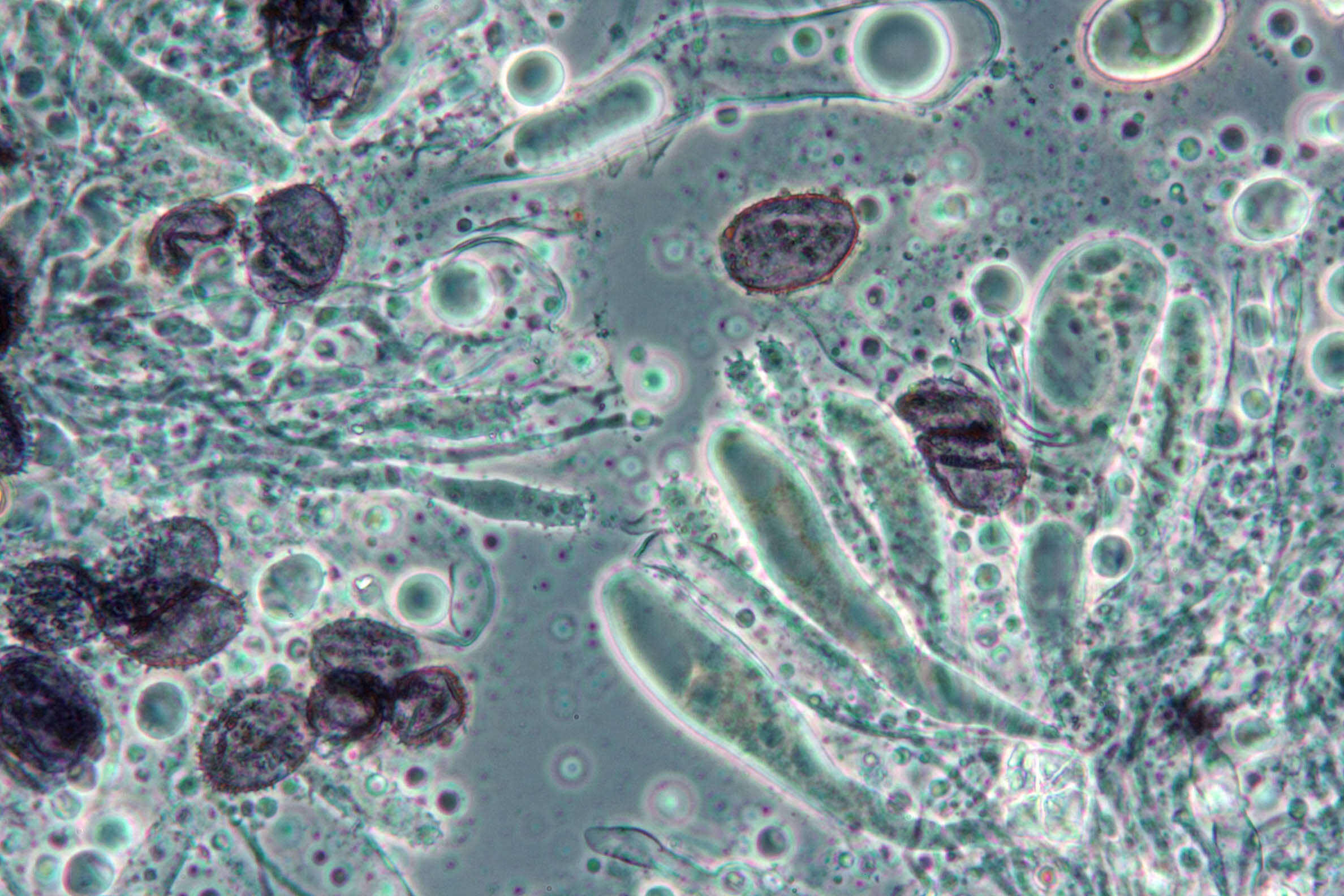 Image of Aleurodiscus wakefieldiae Boidin & Beller 1967