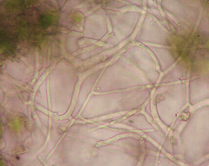Image of unclassified Lecanoromycetes