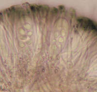 Image of Tiny button lichen