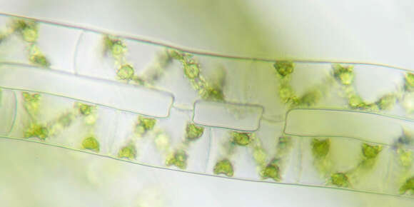 Image of Spirogyra Link 1820