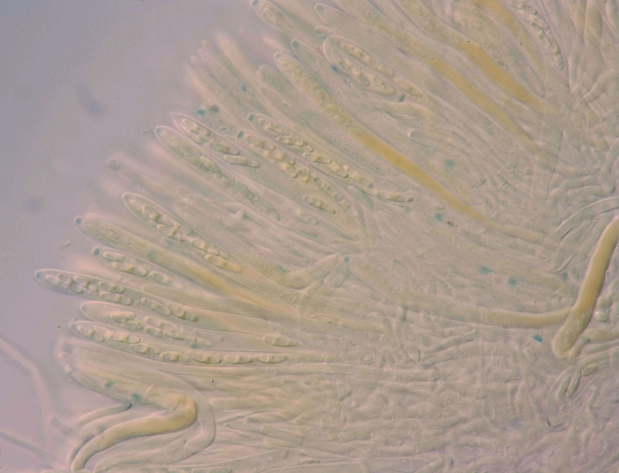 Image de Chlorociboria aeruginascens (Nyl.) Kanouse ex C. S. Ramamurthi, Korf & L. R. Batra 1958