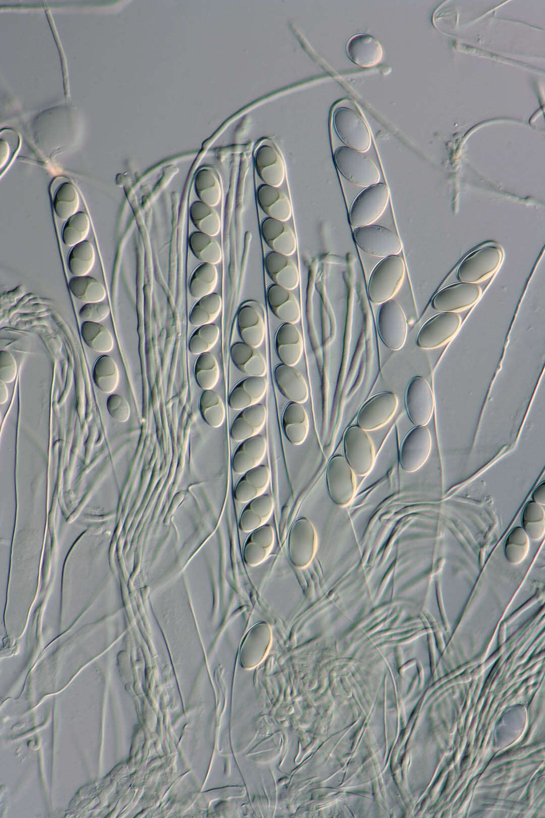 Image of Tarzetta spurcata (Pers.) Harmaja 1974