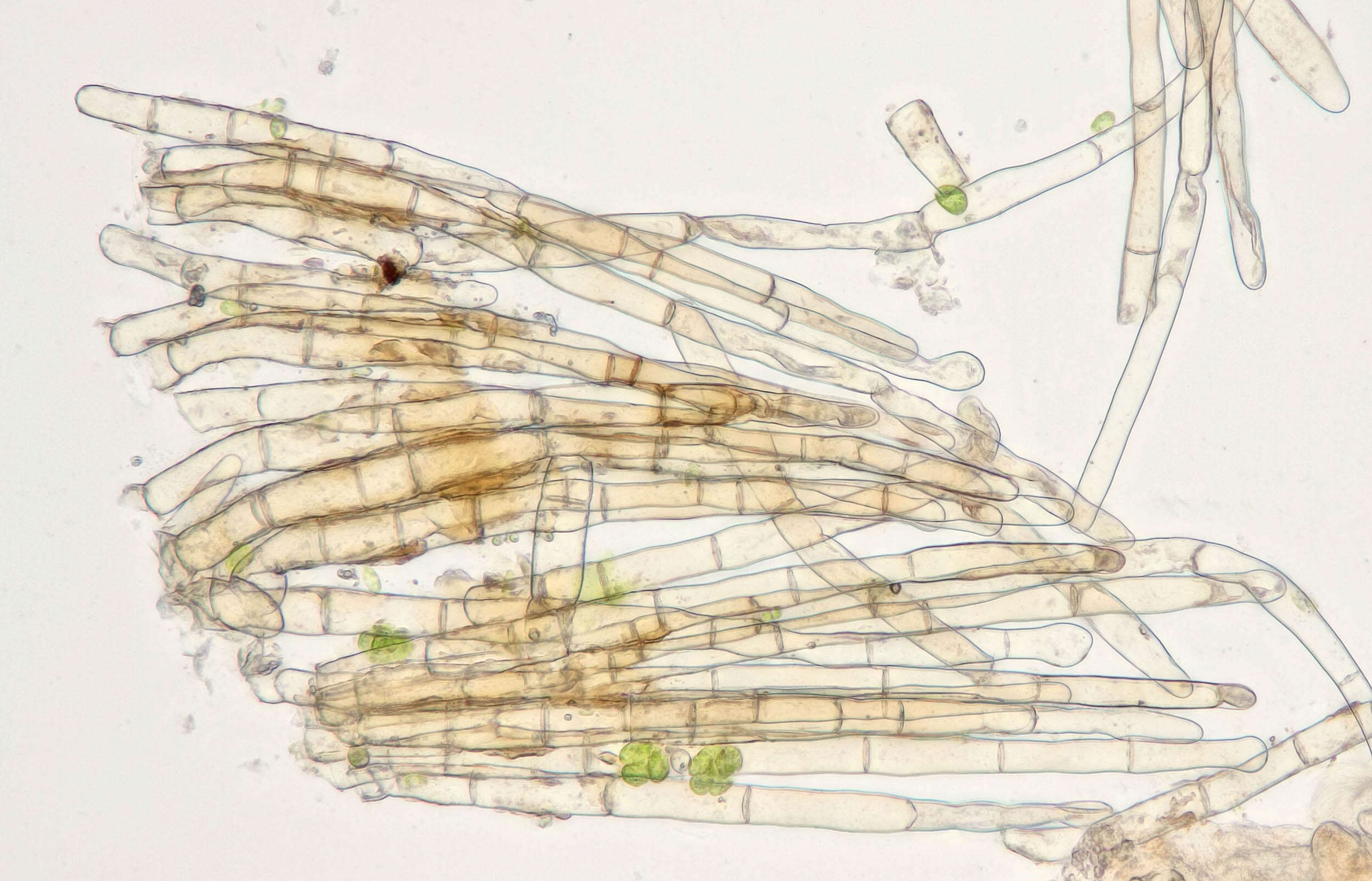 Image of Melastiza contorta (Massee & Crossl.) Spooner & Y. J. Yao 1995