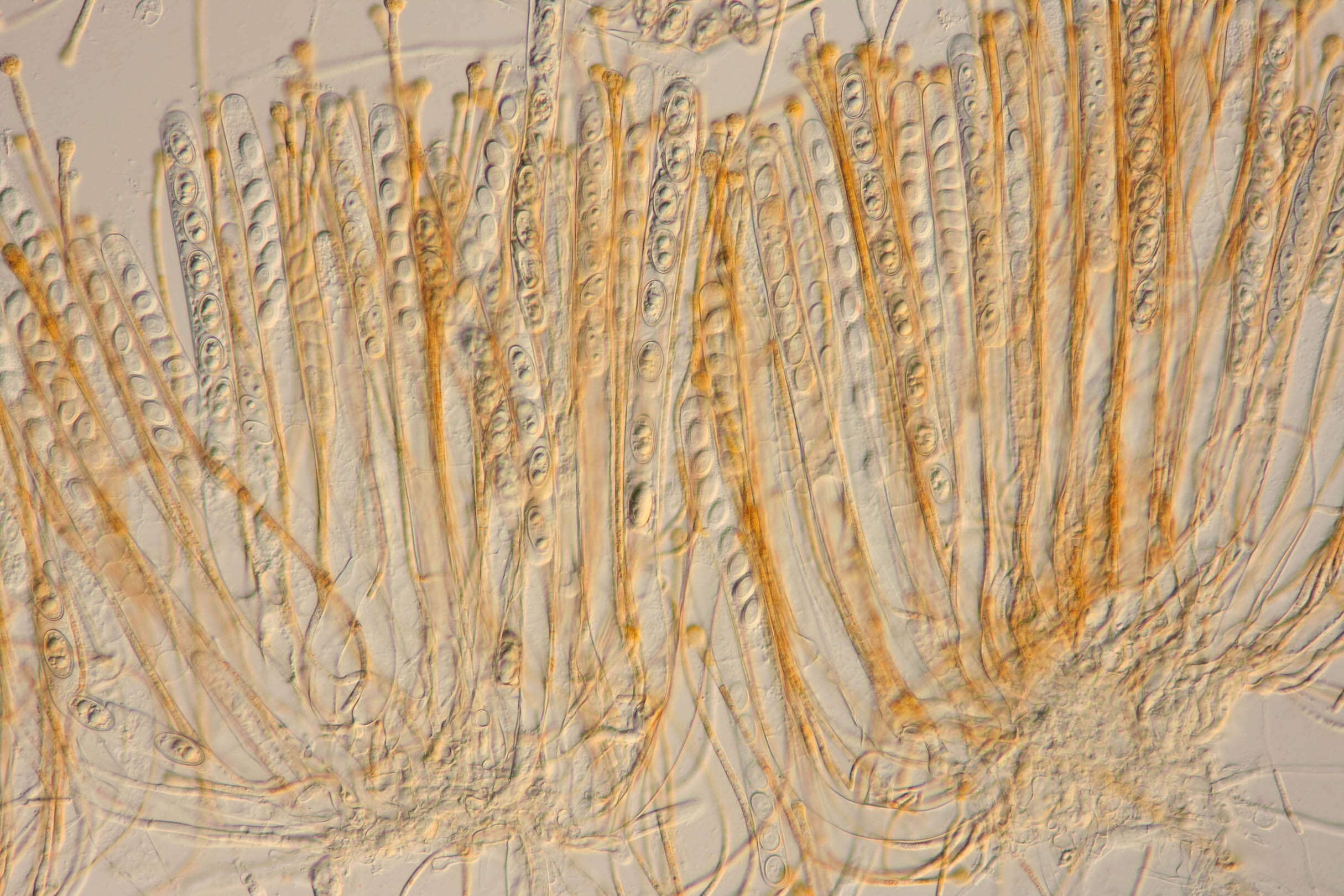 Image of Melastiza contorta (Massee & Crossl.) Spooner & Y. J. Yao 1995