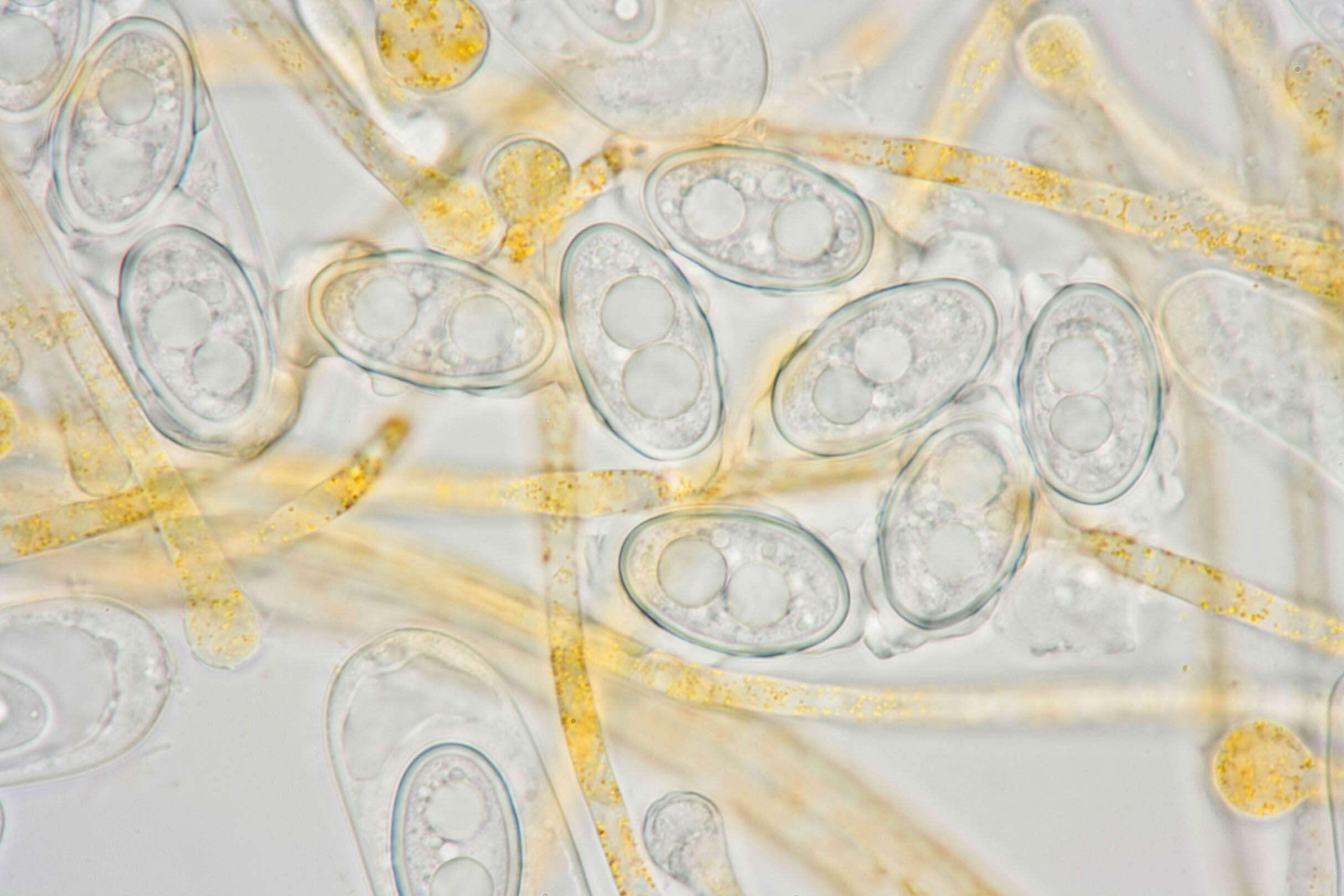 Image of Melastiza contorta (Massee & Crossl.) Spooner & Y. J. Yao 1995