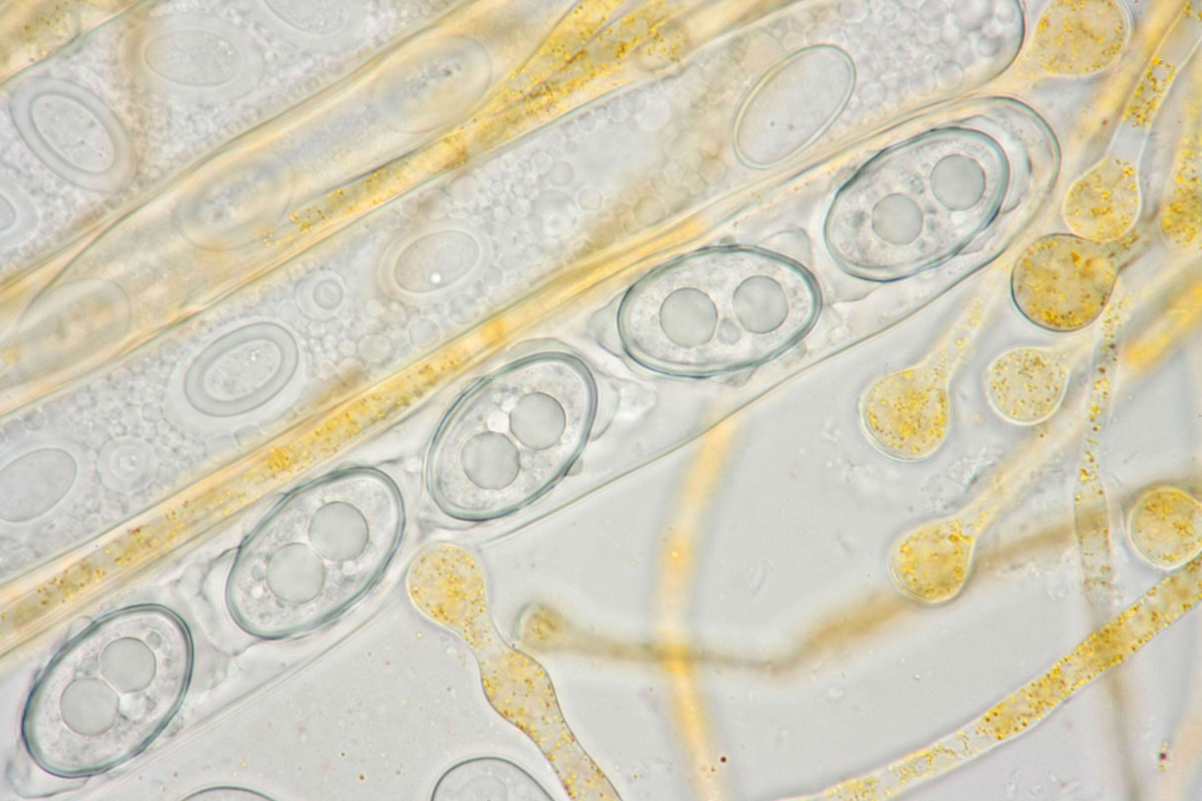 Image of Melastiza contorta (Massee & Crossl.) Spooner & Y. J. Yao 1995