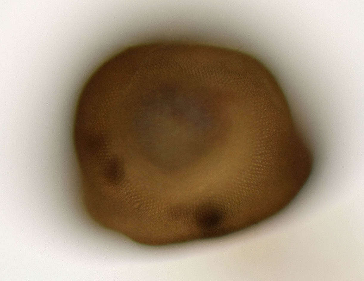 Image of Arcella vulgaris