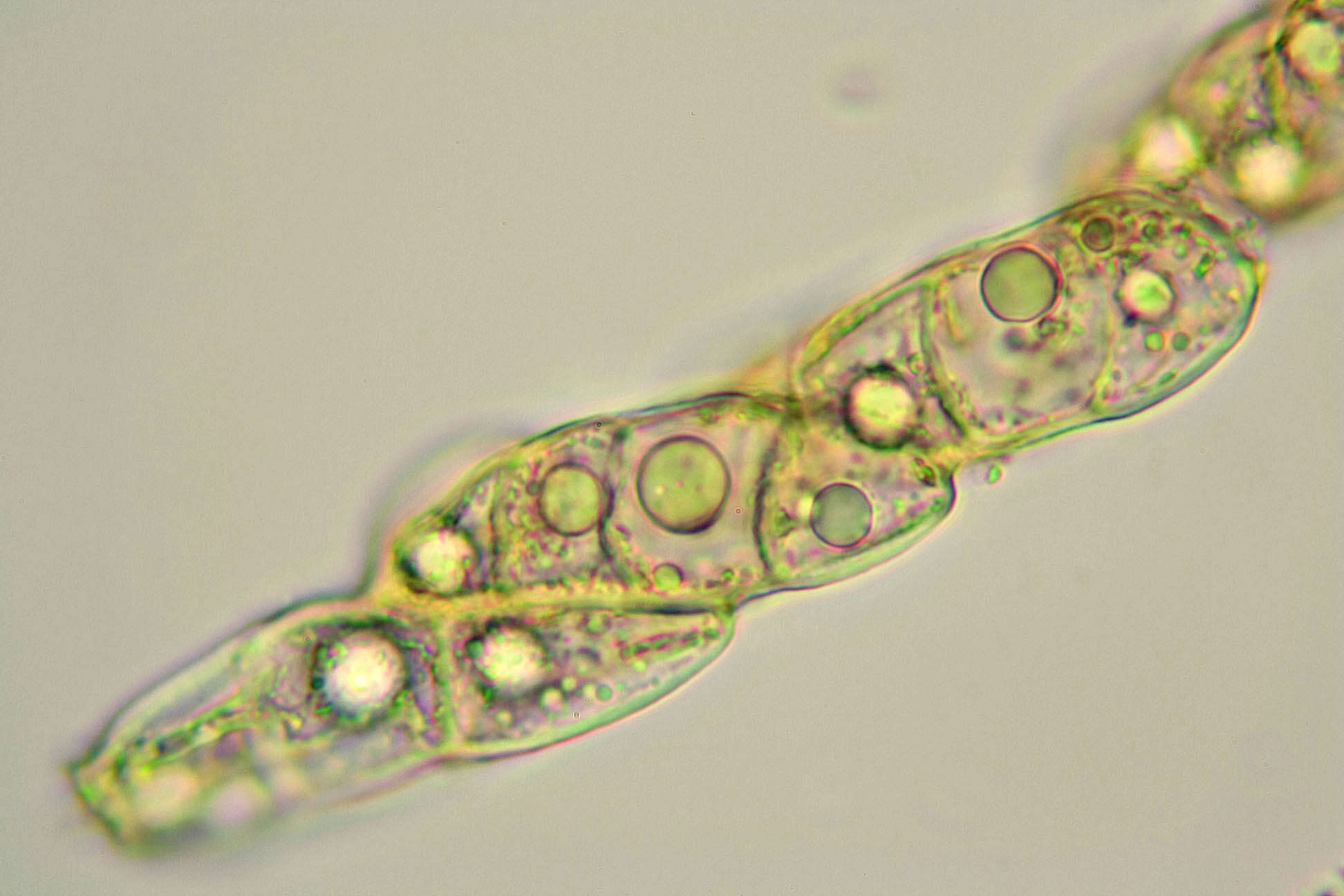 Image of soil jelly lichen