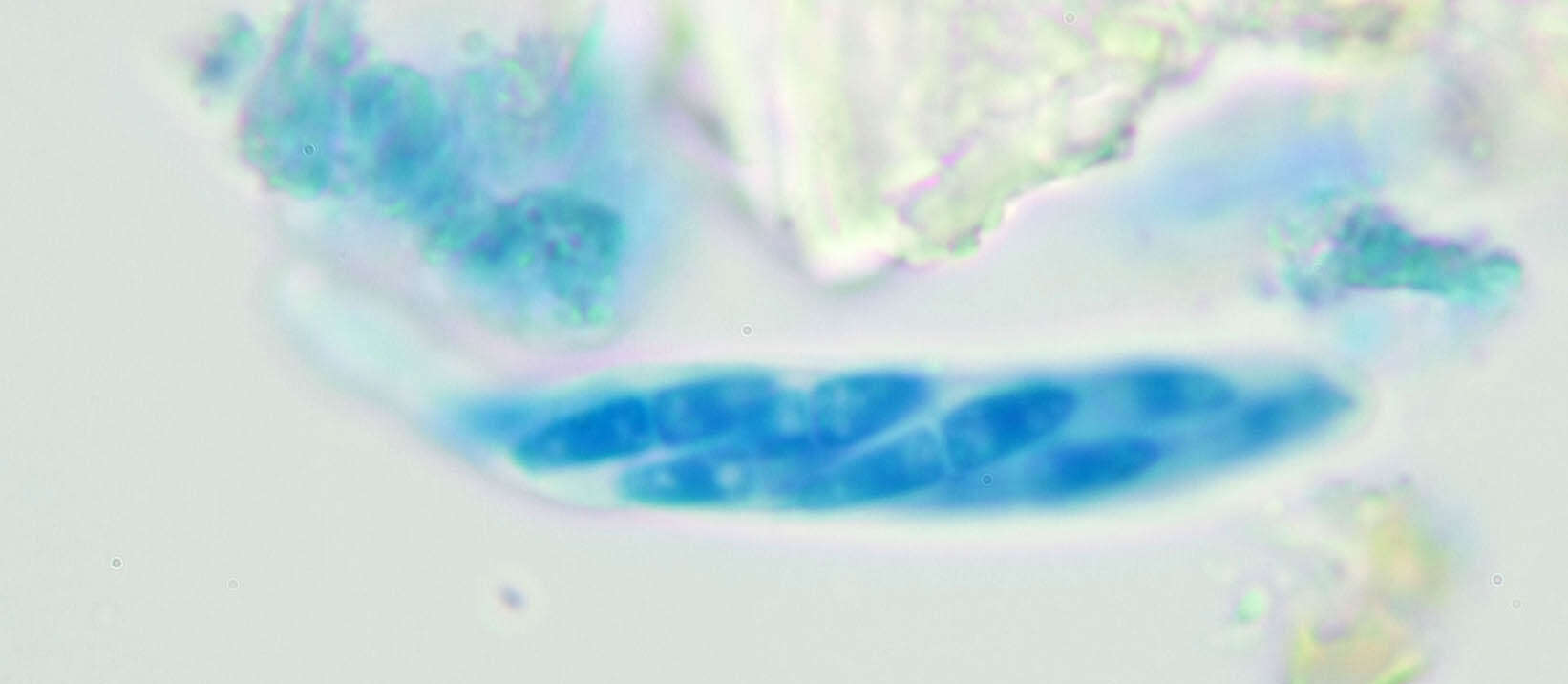 Image of Mycosphaerella hedericola (Cooke) Lindau 1897