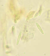 Image of Mycosphaerella hedericola (Cooke) Lindau 1897