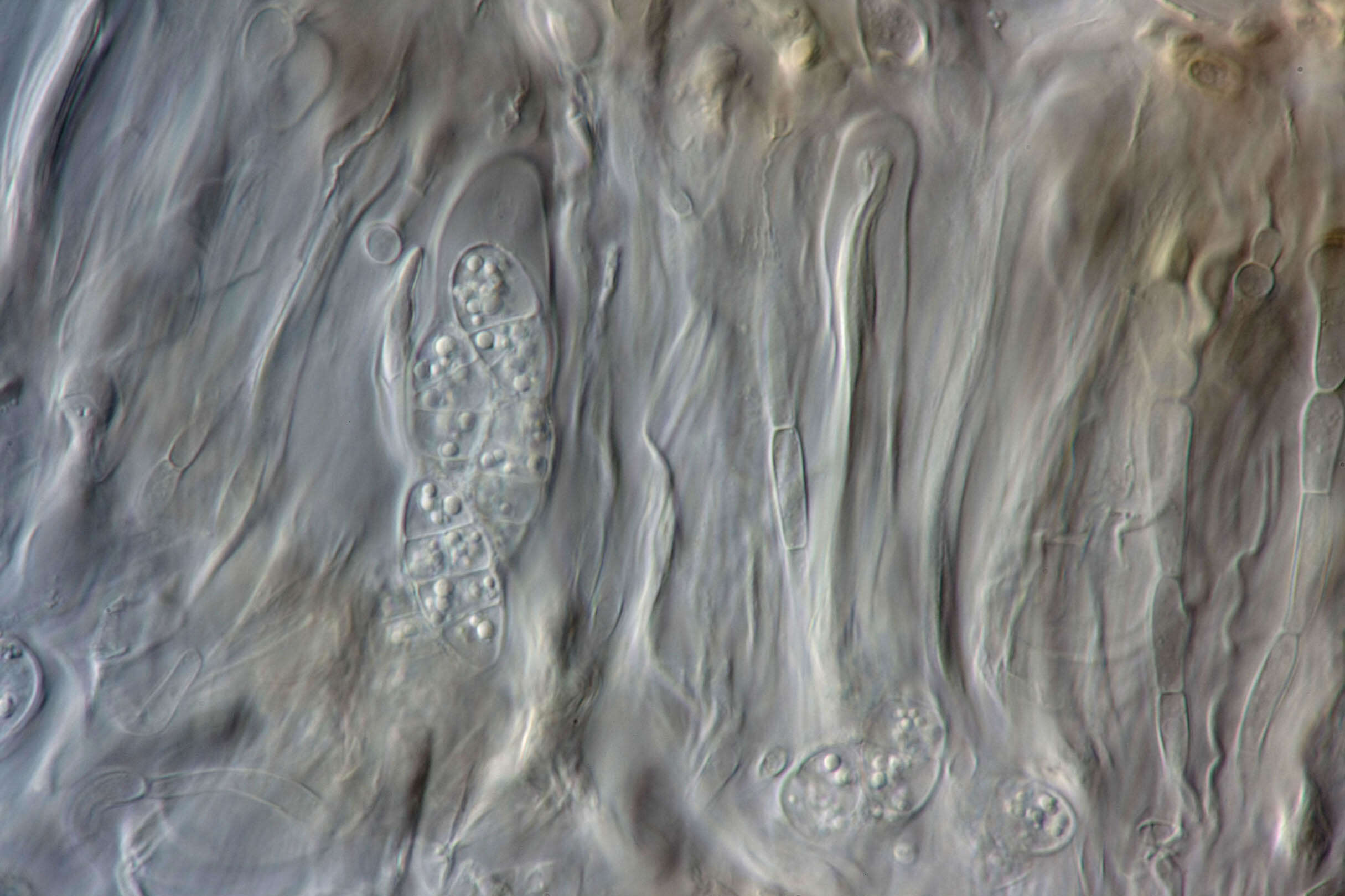 Image of soil jelly lichen