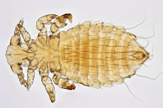 Image of Sucking louse