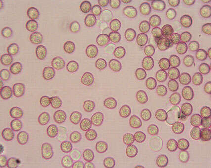 صورة Microbotryum lychnidis-dioicae (DC.) G. Deml & Oberw. 1982