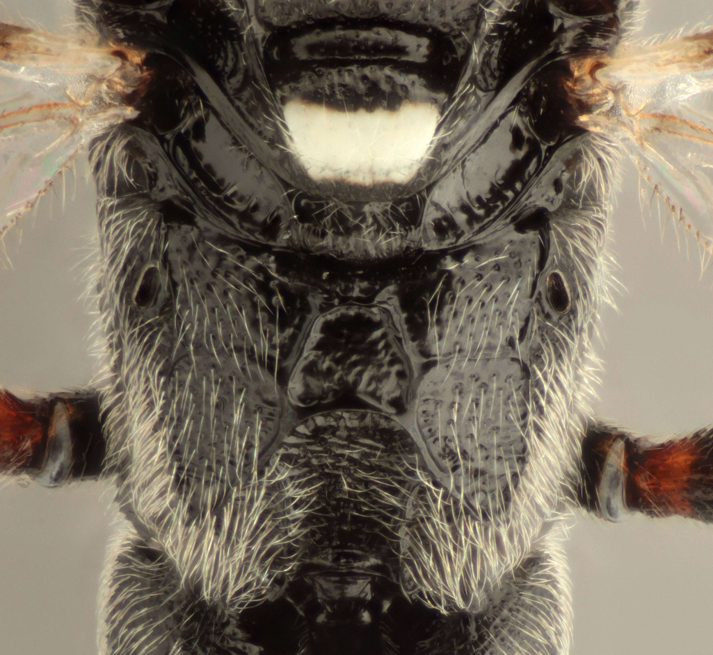 Image of Stenobarichneumon basiglyptus (Kriechbaumer 1890)