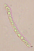 Image of Cercophora coprophila (Fr.) N. Lundq. 1972