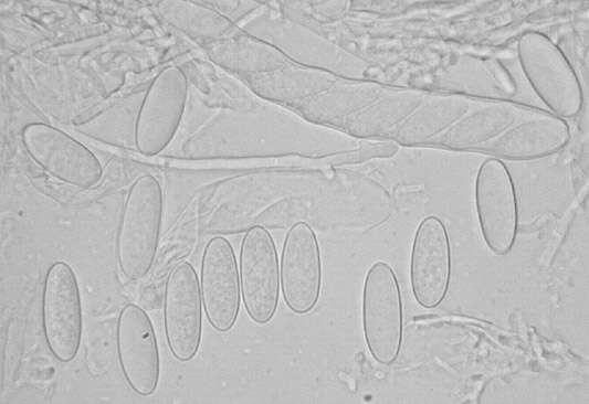 Image of Lachnellula occidentalis (G. G. Hahn & Ayers) Dharne 1965