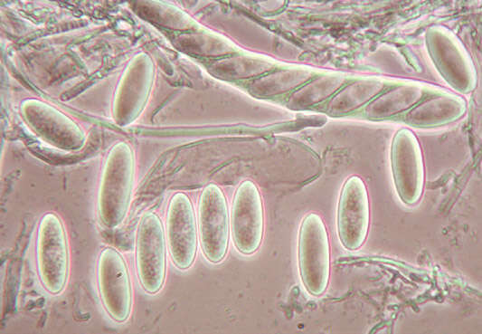 Image of Lachnellula occidentalis (G. G. Hahn & Ayers) Dharne 1965